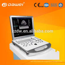 DW-C60 tragbare Doppler-Ultraschall-Maschine und vaskuläre Doppler